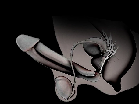 UltraMassix review no.2